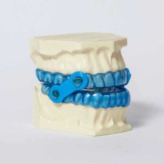 Dispositivo de avance mandibular - Centro Dental Archena